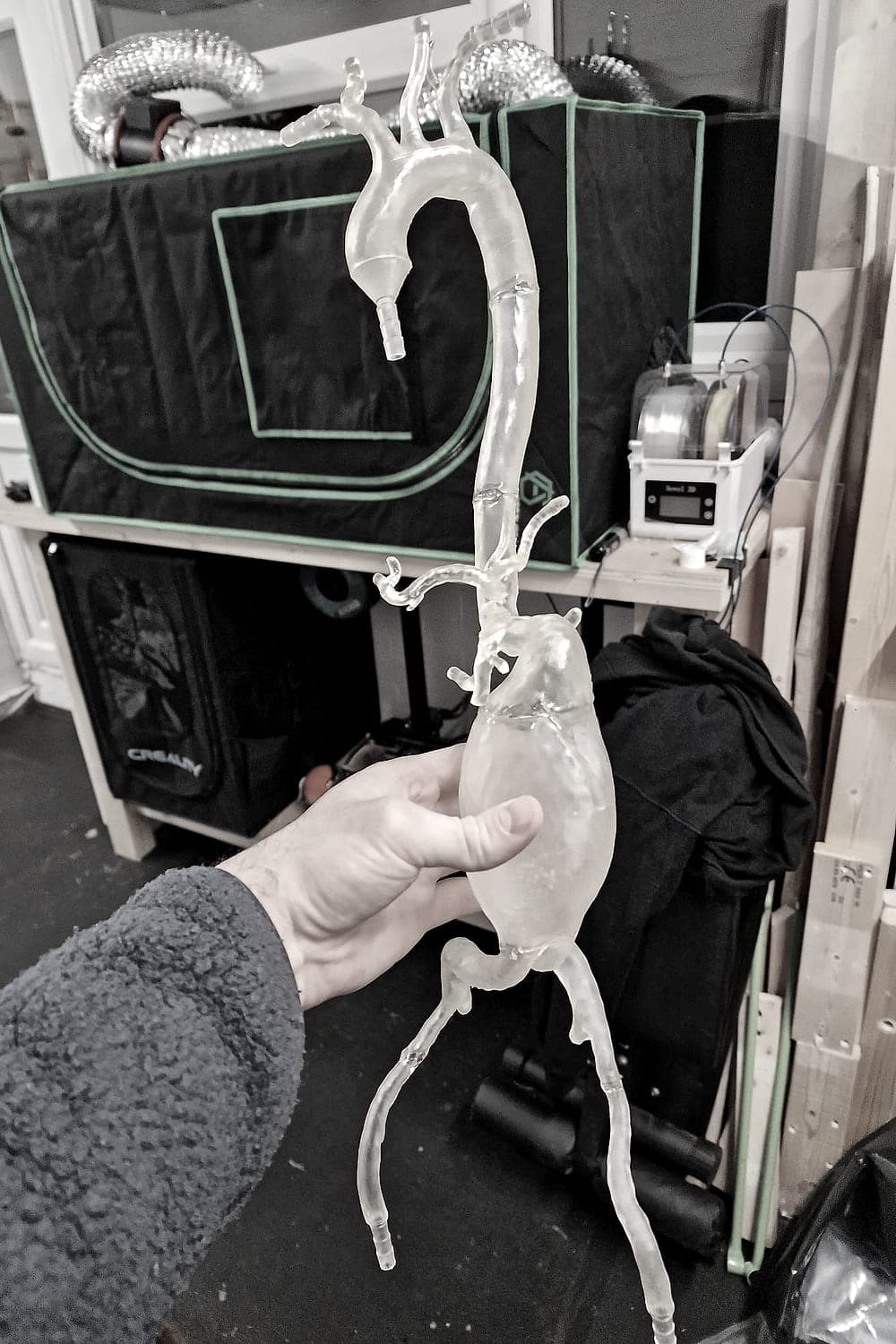 Clear resin model of the aorta and iliac arteries held in one hand, showing its full length